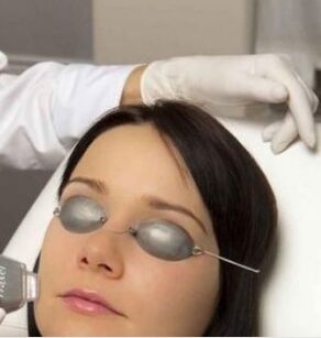 Feld Laser Rejuvenation