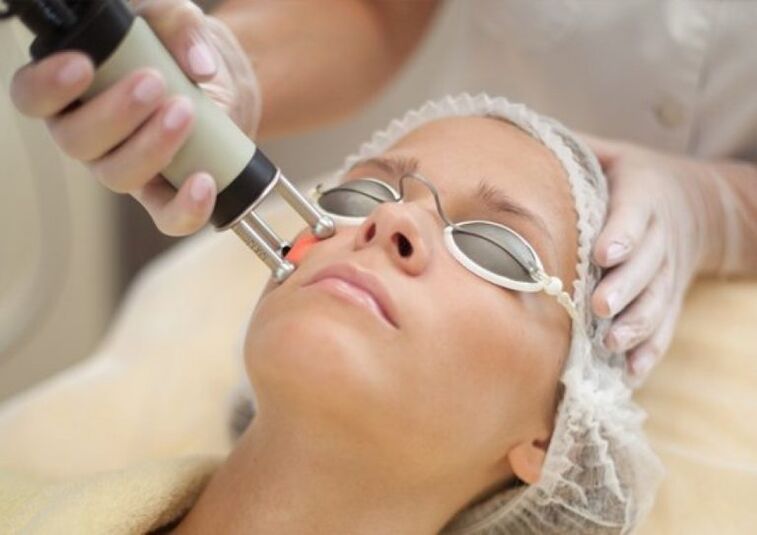 Feld Laser Rejuvenation Prozedur