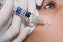 Biorevitaliséierung Prozedur