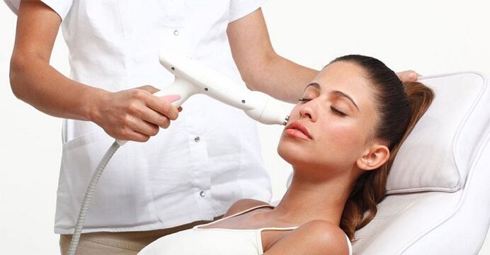 Gesiicht photorejuvenation Prozedur